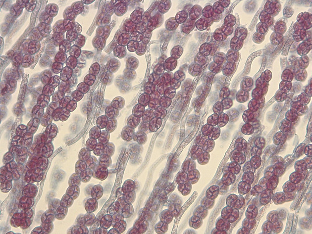 Liverwort Sporophyte Slides - Liverwort Sporophyte 04 400X